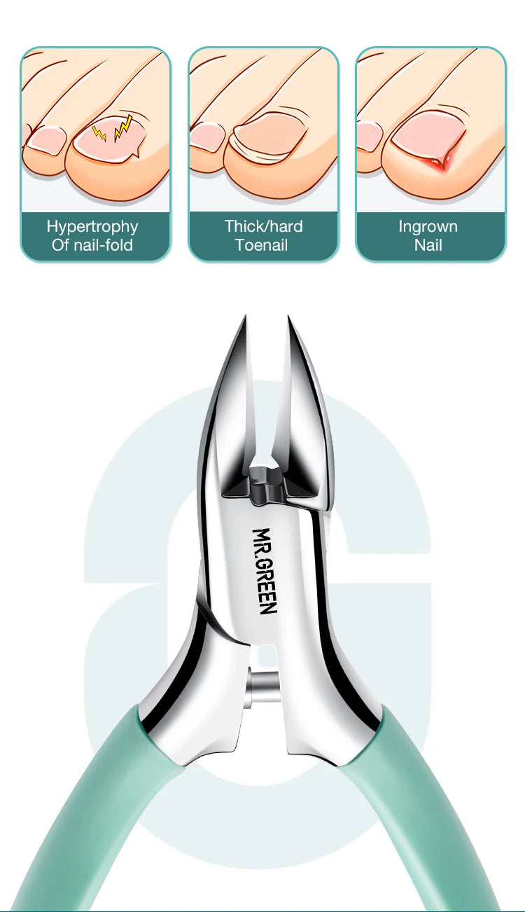 MR.GREEN Toenail Clippers Anti-Splash Ingrown Nail Olecranon Cutters Professional Pedicure Tools Stainless Steel